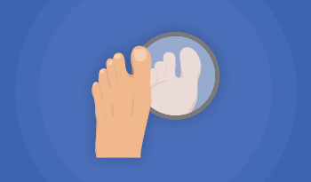 E-læringskursus i diabetiske fodsår