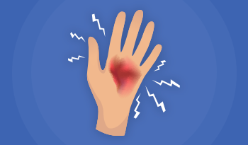 Kvalicare e-læring om Sårbehandling